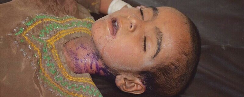 دنیا کی 50فیصد آبادی خسرہ سے متاثر ہونے کا خدشہ ہے، عالمی ادارہ صحت