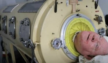 72سال تک مصنوعی آہنی پھیپھڑوں پر زندگی گزارنے والے پال الیگزینڈر انتقال کر گئے