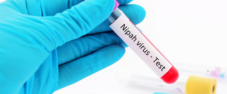 nipha virous