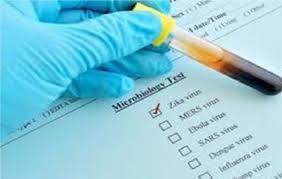 ملک میں زیکا وائرس نے پھر اپنے پیر پھیلانا شروع کئے