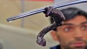 ڈاکٹروں نے اننت ناگ میں ایک نوعمر لڑکے کے نتھنے سے سانپ جیسا کیڑا نکال دیا